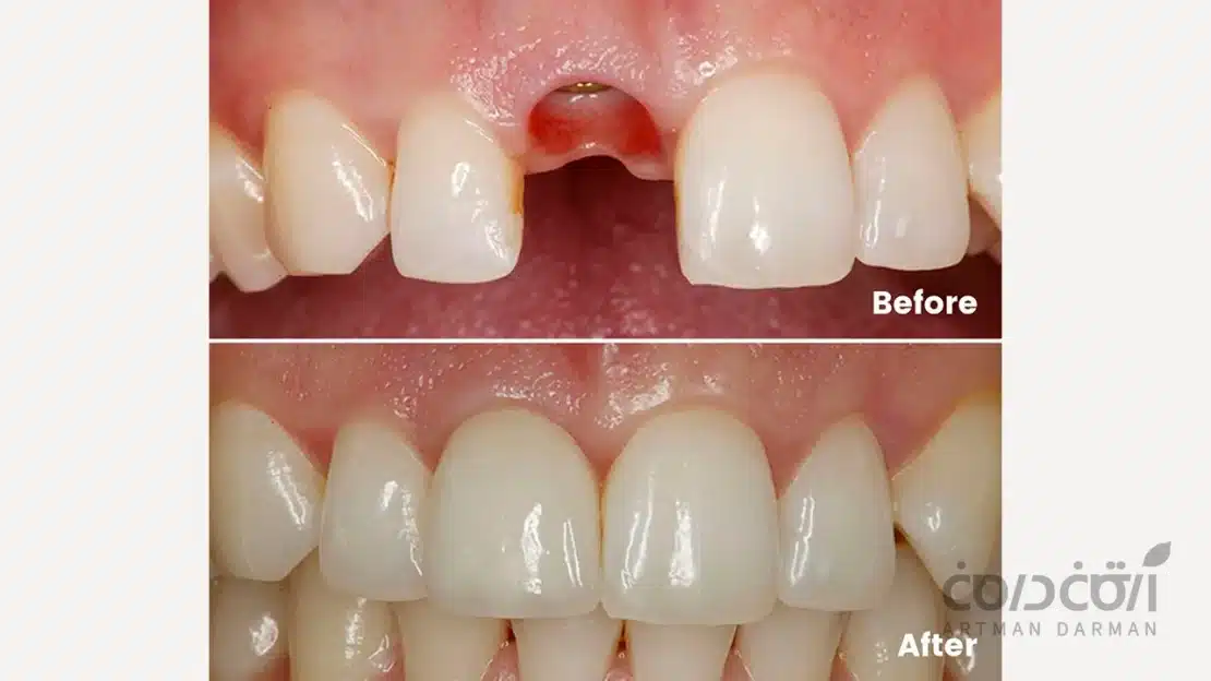 ویزیت توسط دندانپزشک