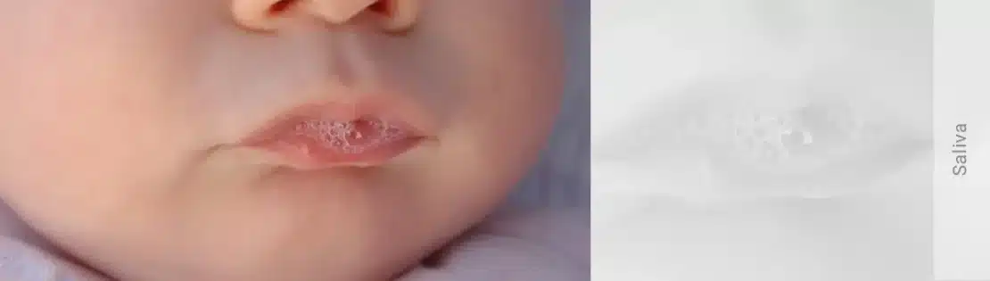تصویر بزاق دهان نوزاد