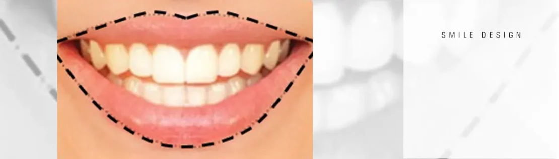 تاثیر لب ها در داشتن لیخندی زیبا