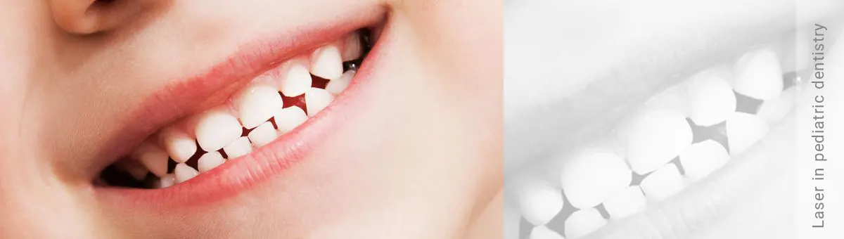 تصویر لبخند کودک