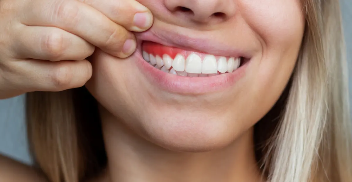 علت درد لثه