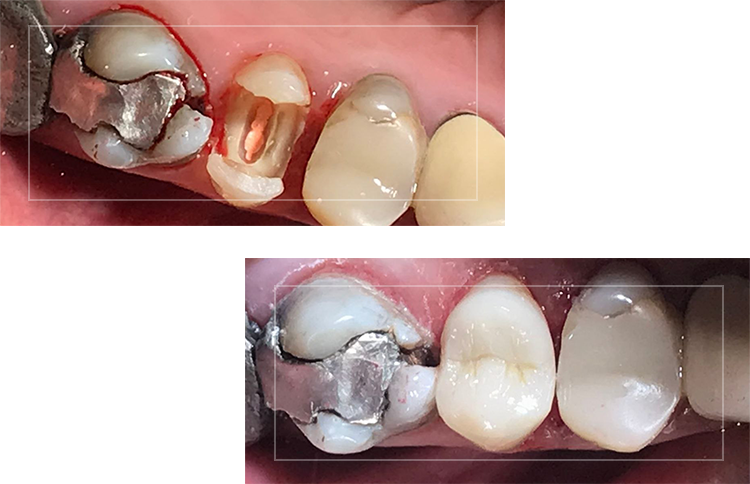 BEFORE-AFTER-PICS-1-1.png