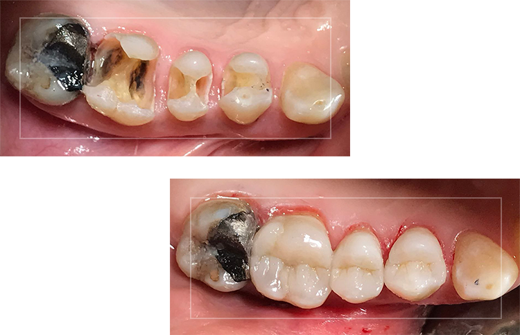 BEFORE-AFTER-PICS.png
