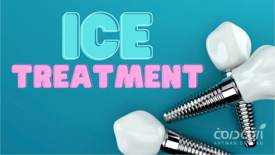 کمپرس سرد بعد از ایمپلنت دندان