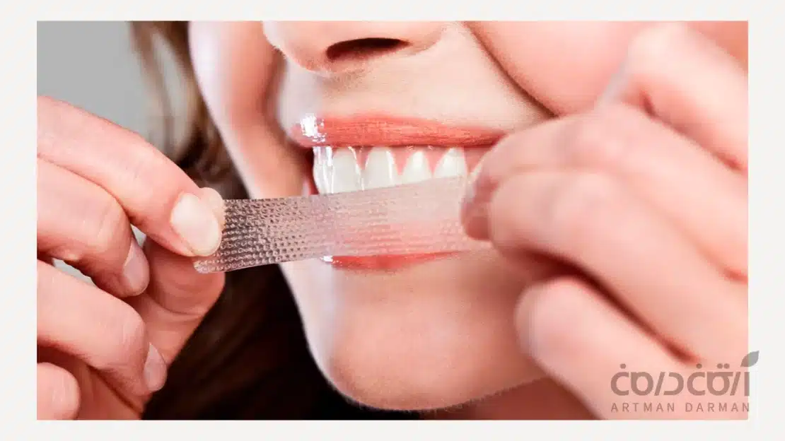 کیت سفید کننده بدون نسخه