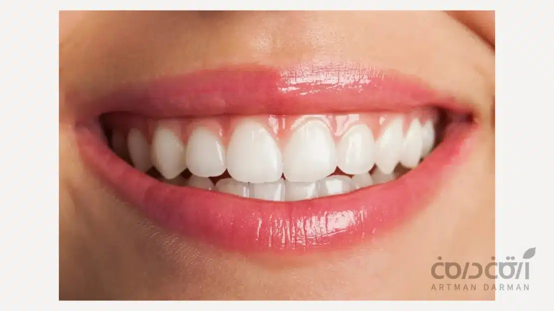تفاوت بلیچینگ و جرمگیری دندان در چیست؟ تفاوت جرم گیری و بلیچینگ دندان