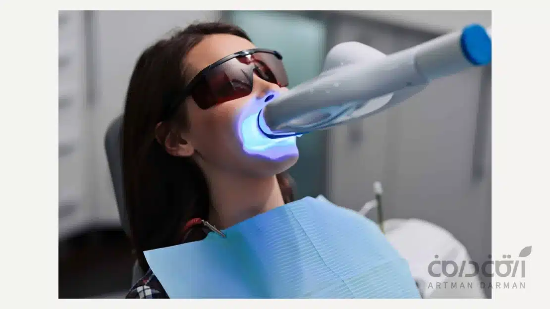 بلیچینگ دندان در مطب