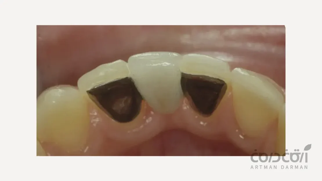 مریلند بریج