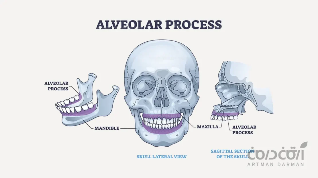 استخوان اطراف دندان