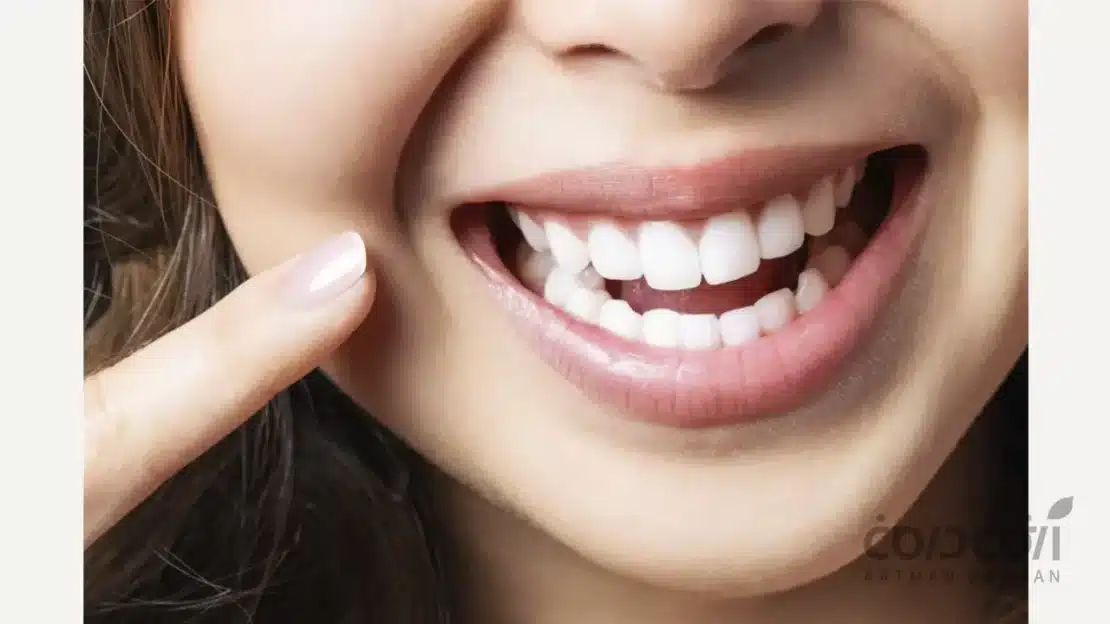 لبخند و دندان های طبیعی