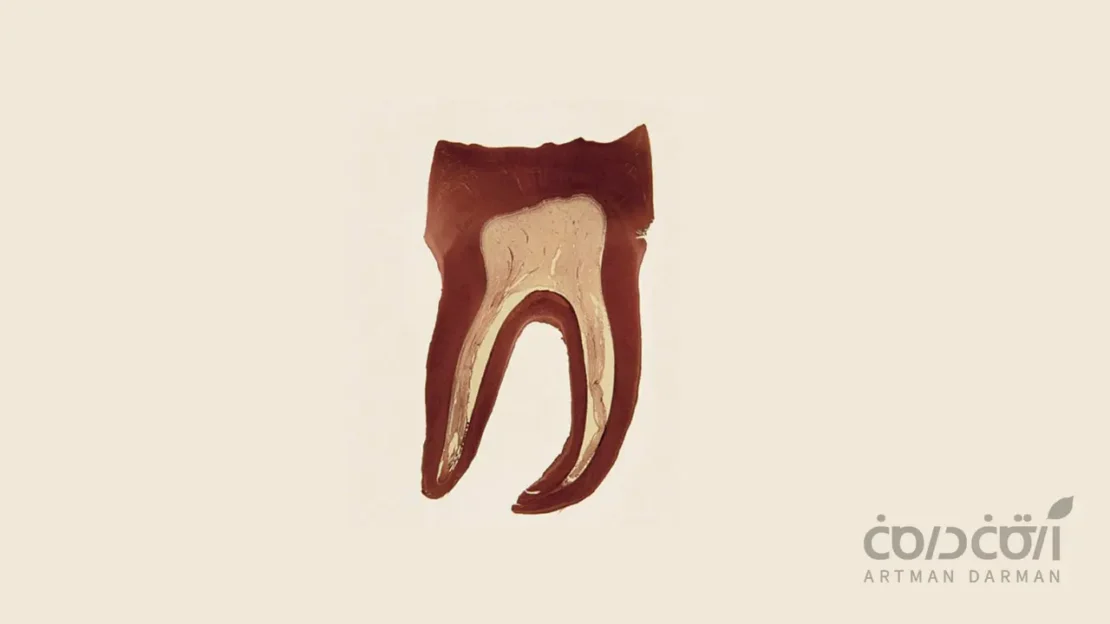 پالپ دندان شماتیک